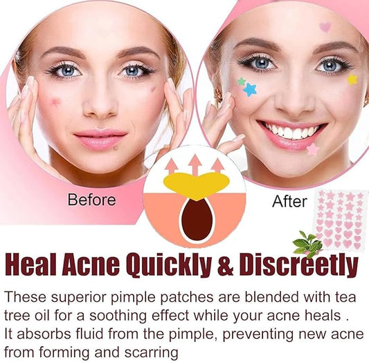 Seven-Color Star Pimple Patches (280/1120/1680pcs) – Fun, Invisible Hydrocolloid Dots for Gentle Skincare